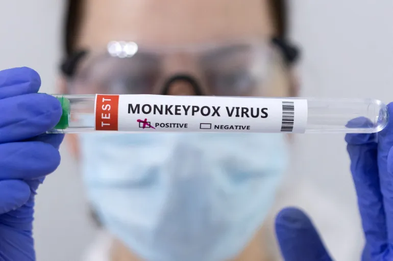 US at risk of losing control of monkeypox outbreak