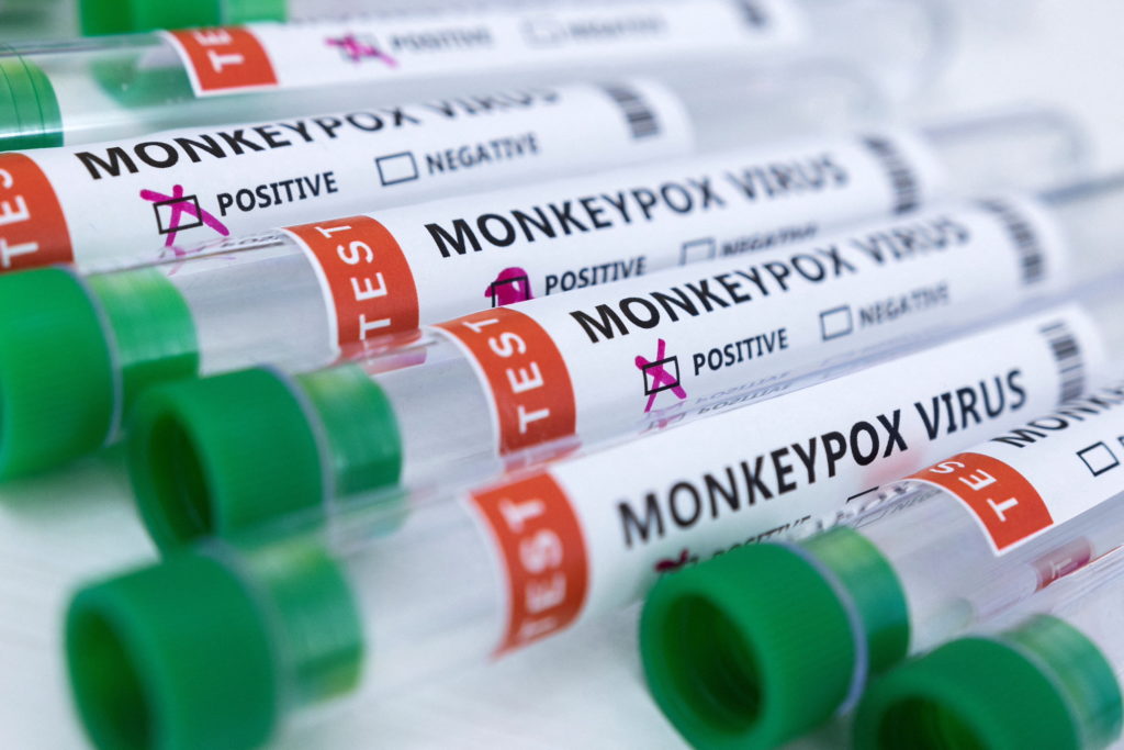 WHO again considers declaring monkeypox a global emergency