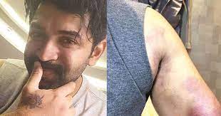 Arun Vijay injured during shooting