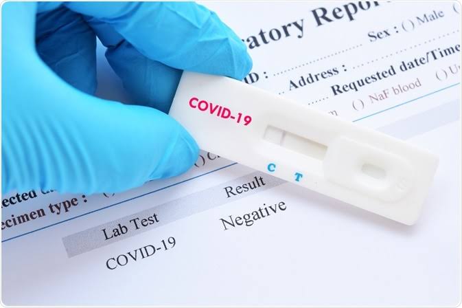 India reports 74 new Covid cases