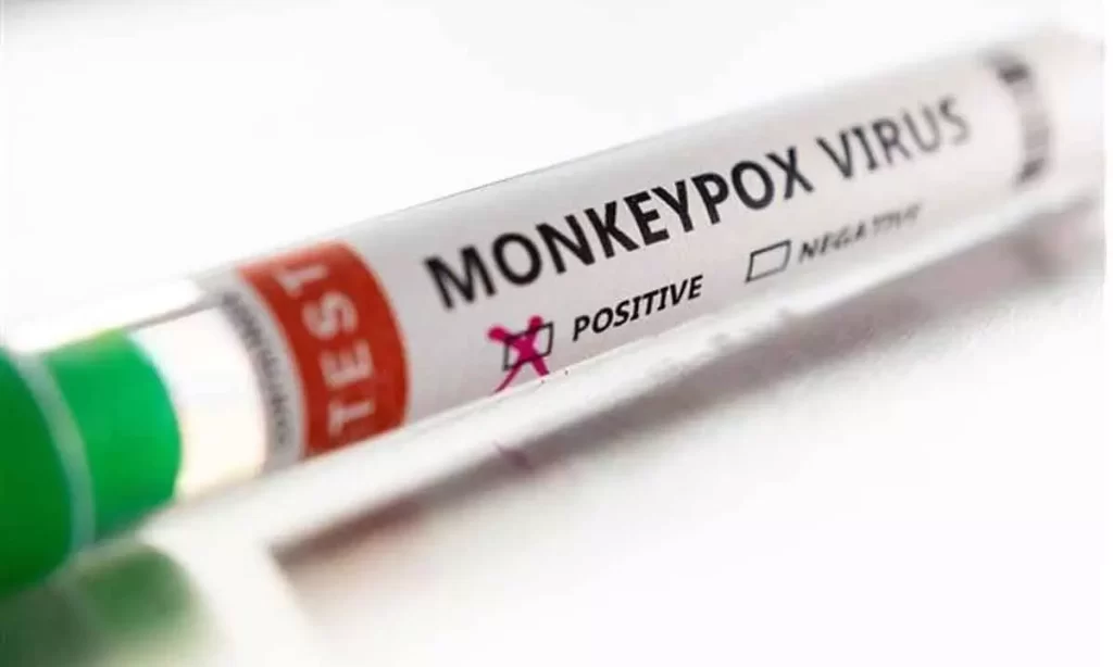 Another monkeypox case reported in India