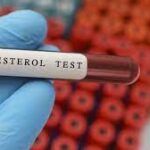 Why early cholesterol testing is important ?
